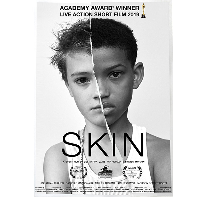 SKIN/スキン